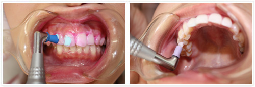 多月歯科クリニック-公式webサイト-